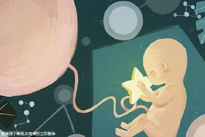 关于极光
